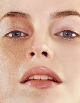 Worried about Dry Skin – Relax here’s something for you!