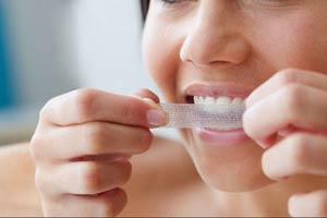 tooth whitening