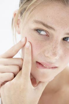 how to get rid of acne