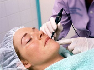 Hirsutism Is The Most Common Problem In Women!