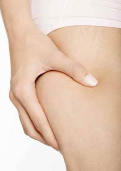 Reshape Your Body And Boost Your Confidence With Cellulite Cure!