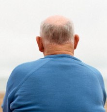 Are You With Excessive Hair Loss Problem? Baldness Cure To Control Your Hair Loss!