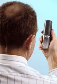 Hair Restoration Surgery – The Best Procedure That Gives Permanent Results!