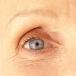 Natural Treatments For Under Eye Wrinkles