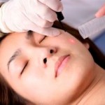 Moles Should Always Be Watched For Changes