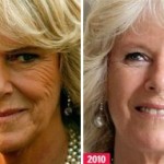 bee venom to fight signs of aging