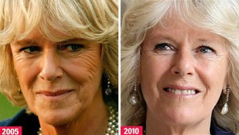 bee venom to fight signs of aging