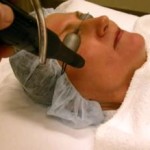 The Laser And Saying “Good Bye To Scars”