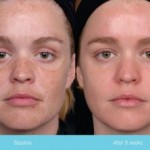 little known treatment