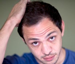 Alopecia Areata Causes