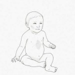 Figuring Out Your Baby Skin Rash