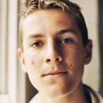 Laser Skin Treatments