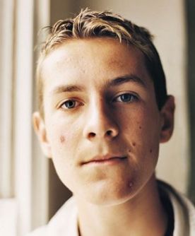 Laser Skin Treatments