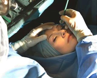 Skin Laser Treatment