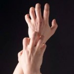 Causes of Itchy Skin