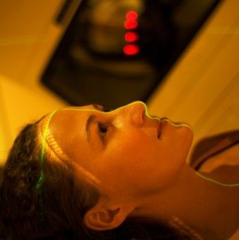 Laser Treatment for Acne