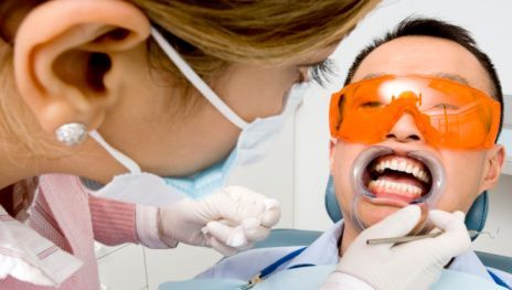 Laser Teeth Whitening