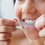 Teeth whitening at home