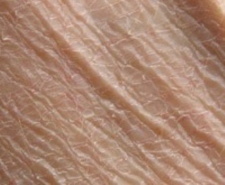 Dry Scaly Skin