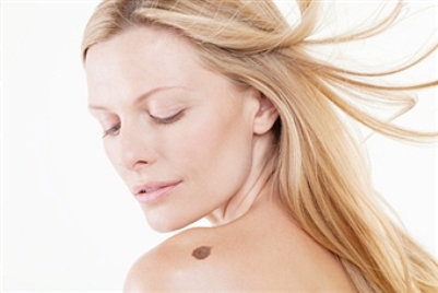 Squamous Cell Skin Cancer