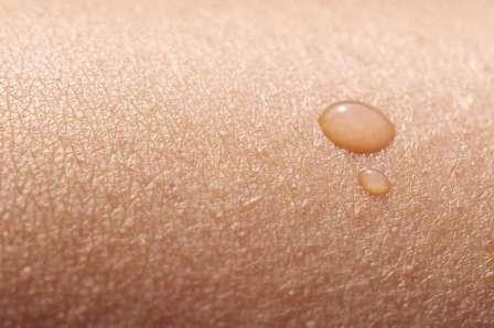 Common Skin Conditions