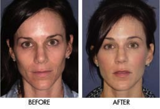 revive-skin-care-side-effects/ Revive Skin Care Side Effects