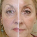 Need to Know Before Choosing Best Wrinkle Cream