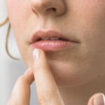 Cracked Lips – How To Fix The Painful Problem