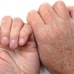 Home Remedies for Severe Dry Skin