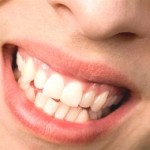 The Chemical Process Behind Teeth Whiteners