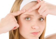 your guide to teenage acne