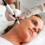 all about collagen induction therapy