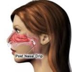 The Correlation between Post Nasal Drip and Bad Breath