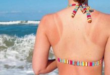 Effective Home Remedies to Get Rid of Tan Effective Home Remedies to Get Rid of Tan